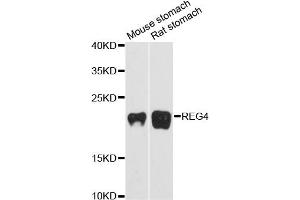 Western blot analysis of extracts of various cell lines, using REG4 antibody (ABIN6293540) at 1:3000 dilution. (REG4 anticorps)