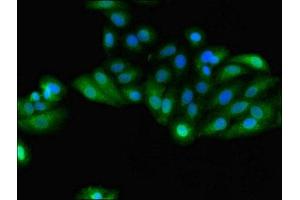 Immunofluorescent analysis of HepG2 cells using ABIN7154093 at dilution of 1:100 and Alexa Fluor 488-congugated AffiniPure Goat Anti-Rabbit IgG(H+L)