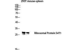 Western Blot (WB) analysis of 293T Mouse Spleen lysis using Ribosomal Protein S4Y1 antibody. (Ribosomal Protein S4Y1 (C-Term) anticorps)