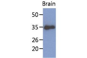 The extract of mouse brain (40ug) were resolved by SDS-PAGE, transferred to PVDF membrane and probed with anti-human KLF7 antibody (1:1000). (KLF7 anticorps)