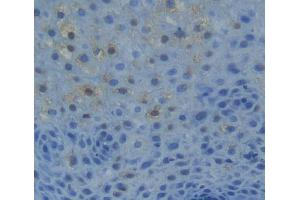 Used in DAB staining on fromalin fixed paraffin- embedded liver tissue (NR1H2 anticorps  (AA 1-446))