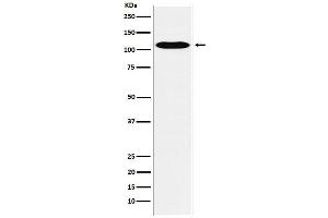 Western blot analysis of GPCR / LGR6 expression in HUVEC cell lysate.