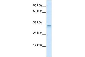 WB Suggested Anti-CGI-62 Antibody Titration:  1. (FAM164A anticorps  (C-Term))