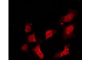 ABIN6275172 staining HeLa by IF/ICC. (RRAD anticorps  (Internal Region))