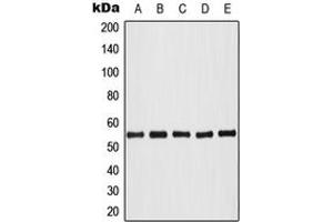 Western blot analysis of AKT (pT308) expression in HeLa colchicine-treated (A), HL60 (B), NIH3T3 (C), SP2/0 colchicine-treated (D), PC12 colchicine-treated (E) whole cell lysates. (AKT1 anticorps  (pSer308))
