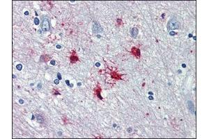 Human Brain, cortex: Formalin-Fixed, Paraffin-Embedded (FFPE) (alpha 1 Adrenergic Receptor anticorps  (AA 206-270))