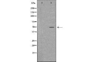 Western blot analysis of K562 whole cell lysates, using PTPN2 Antibody.
