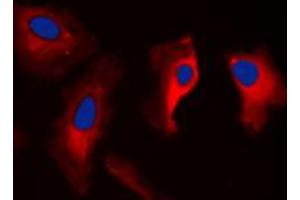 Immunofluorescent analysis of MAST3 staining in HepG2 cells. (MAST3 anticorps  (C-Term))