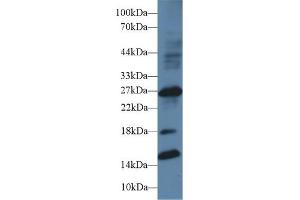 Detection of IGFBP1 in Human Placenta lysate using Polyclonal Antibody to Insulin Like Growth Factor Binding Protein 1 (IGFBP1) (IGFBPI anticorps  (AA 112-262))