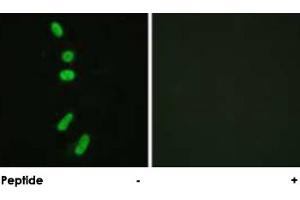 Immunofluorescence analysis of HeLa cells, using SF1 polyclonal antibody . (Splicing Factor 1 anticorps)