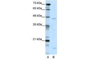 WB Suggested Anti-TRIP13  Antibody Titration: 5. (TRIP13 anticorps  (C-Term))
