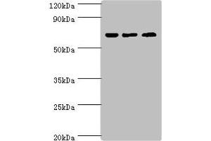 Western blot All lanes: PIAS2 antibody at 2 μg/mL Lane 1: A431 whole cell lysate Lane 2: HepG2 whole cell lysate Lane 3: Mouse brain tissue Secondary Goat polyclonal to rabbit IgG at 1/10000 dilution Predicted band size: 69, 64, 46 kDa Observed band size: 69 kDa (PIAS2 anticorps  (AA 532-621))