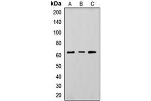 Western blot analysis of CD73 expression in HepG2 (A), K562 (B), A375 (C) whole cell lysates. (CD73 anticorps  (Center))