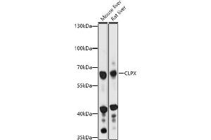 Western blot analysis of extracts of various cell lines, using CLPX antibody (ABIN7266418) at 1:1000 dilution. (CLPX anticorps  (AA 500-600))