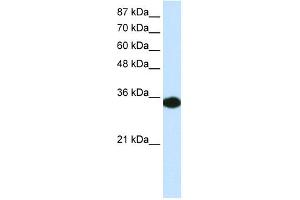 WB Suggested Anti-HOXD4 Antibody Titration: 0. (HOXD4 anticorps  (C-Term))