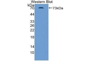 Western blot analysis of the recombinant protein. (INHBB anticorps  (AA 50-404))