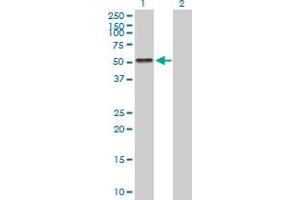 Western Blot analysis of AGT expression in transfected 293T cell line by AGT MaxPab polyclonal antibody.
