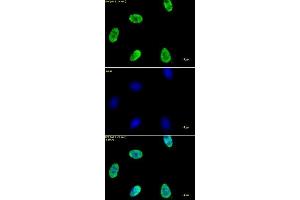 Histone H4 acetyl Lys12 antibody tested by immunofluorescence. (Histone H4 anticorps  (acLys12))
