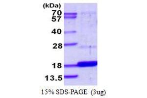 SDS-PAGE (SDS) image for Dual Specificity Phosphatase 23 (DUSP23) (AA 1-150) protein (His tag) (ABIN667982)