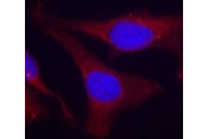 Immunofluorescence staining of methanol-fixed HeLa cells using Phospho-PTPN6-Y536 antibody (ABIN2988271). (SHP1 anticorps  (pTyr536))