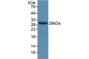 Figure. (alpha 2 Macroglobulin anticorps  (AA 616-856))