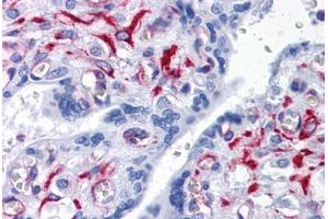 Human Placenta: Formalin-Fixed, Paraffin-Embedded (FFPE)