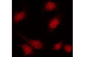 ABIN6275357 staining A549 by IF/ICC. (PIP5K1C anticorps  (Internal Region))