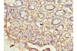 Immunohistochemistry of paraffin-embedded human small intestine tissue using ABIN7165103 at dilution of 1:100 (ARMCX6 anticorps  (AA 28-300))