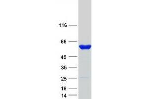 Validation with Western Blot