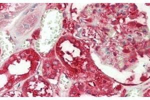 Detection of GSTp in Human Kidney Tissue using Polyclonal Antibody to Glutathione S Transferase Pi (GSTp)