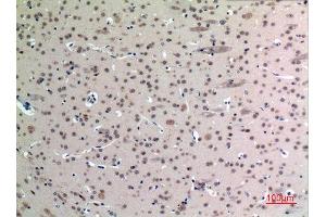 Immunohistochemistry (IHC) analysis of paraffin-embedded Mouse Brain, antibody was diluted at 1:100. (FGF12 anticorps  (Internal Region))