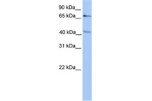 WB Suggested Anti-CHST13 Antibody Titration:  0. (CHST13 anticorps  (N-Term))