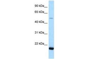 Image no. 1 for anti-seryl-tRNA Synthetase 2, Mitochondrial (SARS2) (AA 108-157) antibody (ABIN6747848) (SARS2 anticorps  (AA 108-157))