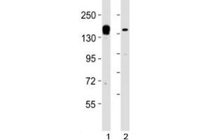 Western blot testing of KDM6A antibody at 1:2000 dilution. (KDM6A anticorps  (AA 1041-1074))