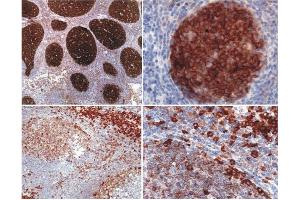 Immunohistochemistry of paraffin-embedded sections Immunohistochemistry staining (paraffin-embedded sections) using anti-Cbp/PAG (MEM-255).