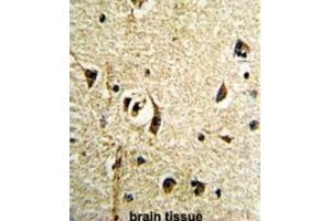 Immunohistochemistry (IHC) image for anti-Fat Mass and Obesity-Associated (FTO) antibody (ABIN3002909)