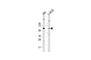 All lanes : Anti-TRIM6 Antibody (N-term) at 1:2000 dilution Lane 1: 293 whole cell lysate Lane 2: U-2OS whole cell lysate Lysates/proteins at 20 μg per lane. (TRIM6 anticorps  (N-Term))