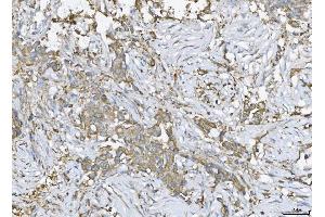 IHC analysis of ATX2/ATXN2 using anti-ATX2/ATXN2 antibody (ABIN3043507). (Ataxin 2 anticorps  (C-Term))