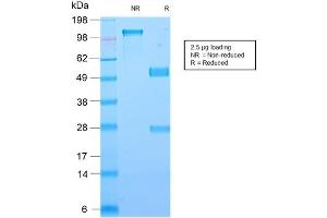 SDS-PAGE Analysis of Purified Galectin-1 Rabbit Recombinant Monoclonal Antibody ABIN6383867. (Recombinant LGALS1/Galectin 1 anticorps  (AA 12-108))