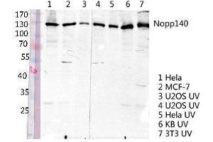 Western Blot (WB) analysis of specific lysis using Nopp140 Polyclonal Antibody. (NOLC1 anticorps  (C-Term))