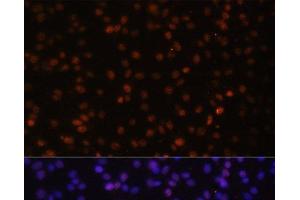 Immunofluorescence analysis of C6 cells using HTATSF1 Polyclonal Antibody at dilution of 1:100. (HTATSF1 anticorps)