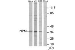 Western Blotting (WB) image for anti-Nucleophosmin (Nucleolar phosphoprotein B23, Numatrin) (NPM1) (AA 1-50) antibody (ABIN2889745) (NPM1 anticorps  (AA 1-50))