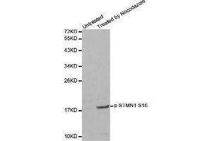 Western blot analysis of extracts from 293 cells, using Phospho-STMN1-S16 antibody. (Stathmin 1 anticorps  (pSer16))