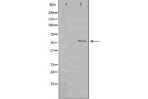 Western blot analysis of extracts from rat lung cells, using EFEMP1 antibody. (FBLN3 anticorps  (Internal Region))