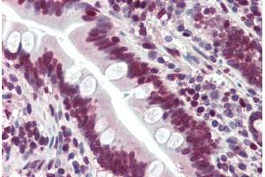Human Small Intestine (formalin-fixed, paraffin-embedded) stained with LASS6 antibody ABIN396945 at 5 ug/ml followed by biotinylated goat anti-rabbit IgG secondary antibody ABIN481713, alkaline phosphatase-streptavidin and chromogen. (CERS6 anticorps  (N-Term))