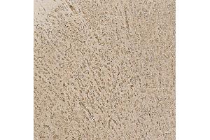 IHC analysis of EIF5 using anti-EIF5 antibody (ABIN7599722). (EIF5 anticorps  (AA 11-423))