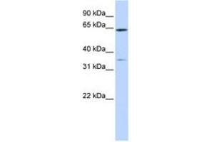 Image no. 1 for anti-Tripartite Motif Containing 45 (TRIM45) (AA 396-445) antibody (ABIN6740818) (TRIM45 anticorps  (AA 396-445))