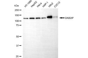 anti-DAB2 Interacting Protein (DAB2IP) antibody