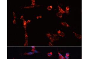 Immunofluorescence analysis of NIH/3T3 cells using MMP16 Polyclonal Antibody at dilution of 1:100. (MMP16 anticorps)