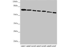 Western blot All lanes: DYNC1I1 antibody at 2. (DYNC1I1 anticorps  (AA 1-220))